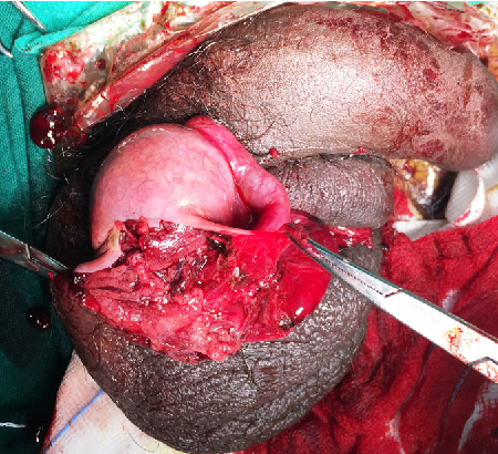 Testicular Trauma