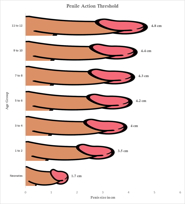 Bbc anal comp