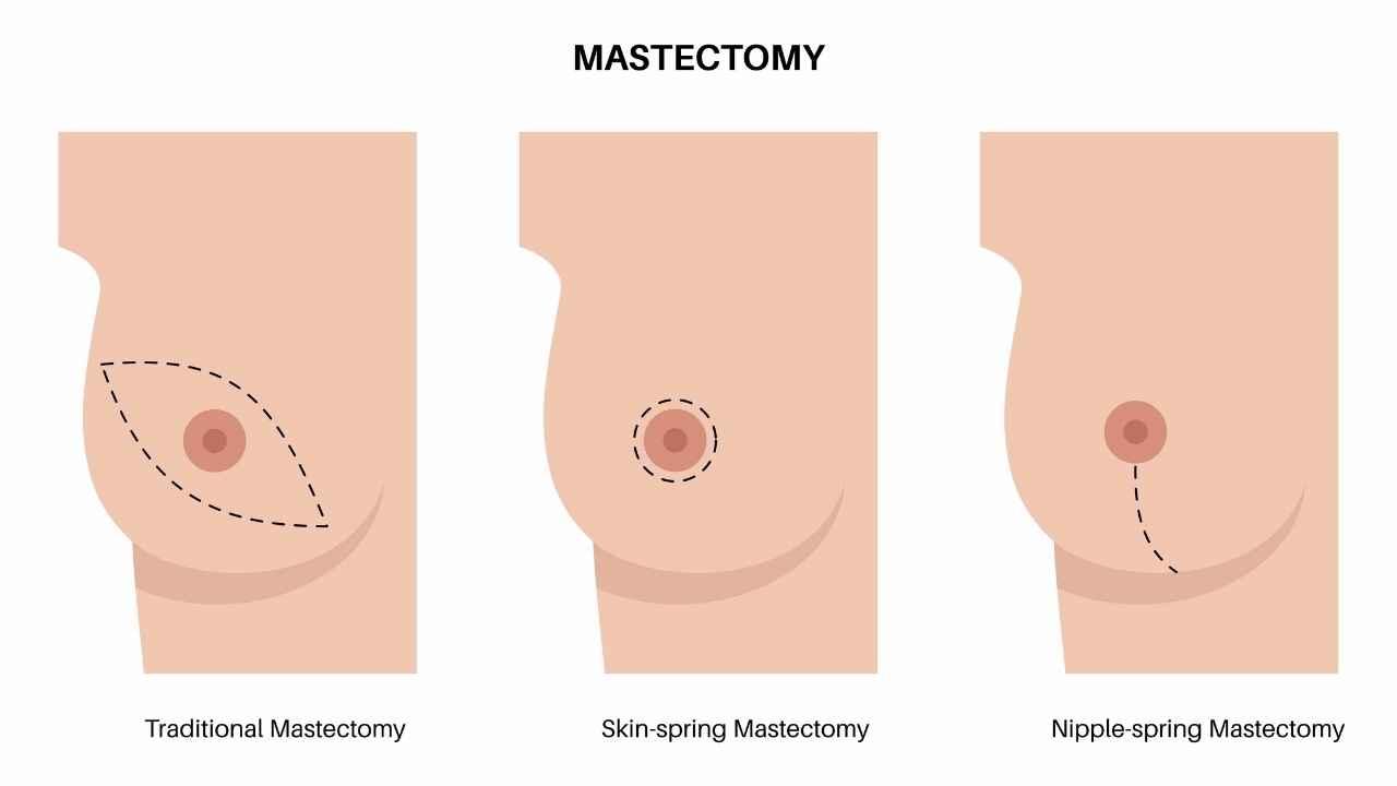 Assessing tumor margins